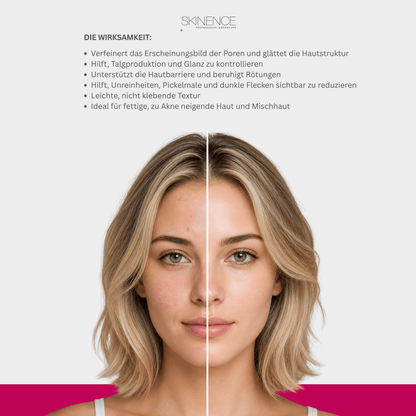 Niacinamide 10% + Zinc 1% Serum - Skinence – Professional Dermacare